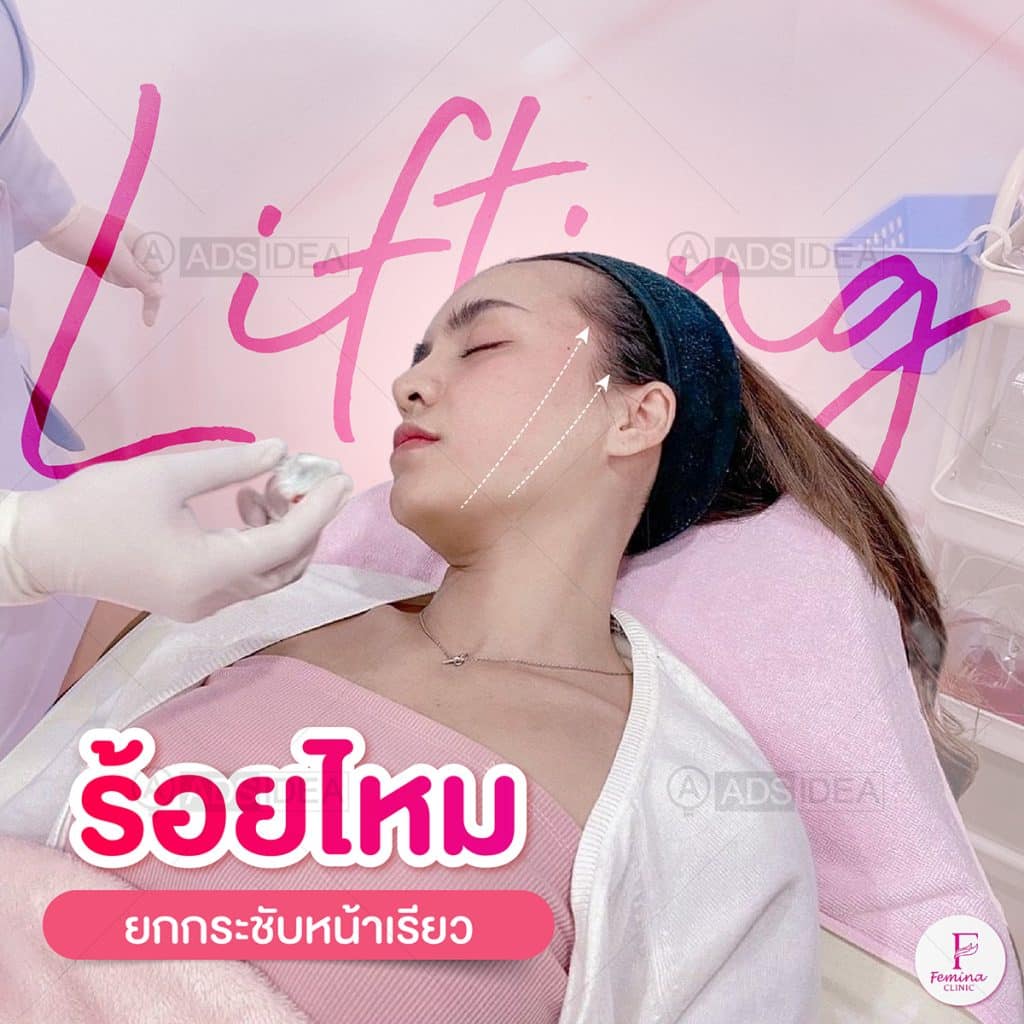 ร้อยไหม ยกกระชับหน้าเรียว