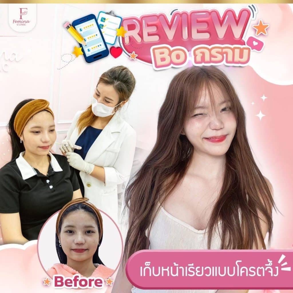 รีวิวโบท็อกซ์กราม