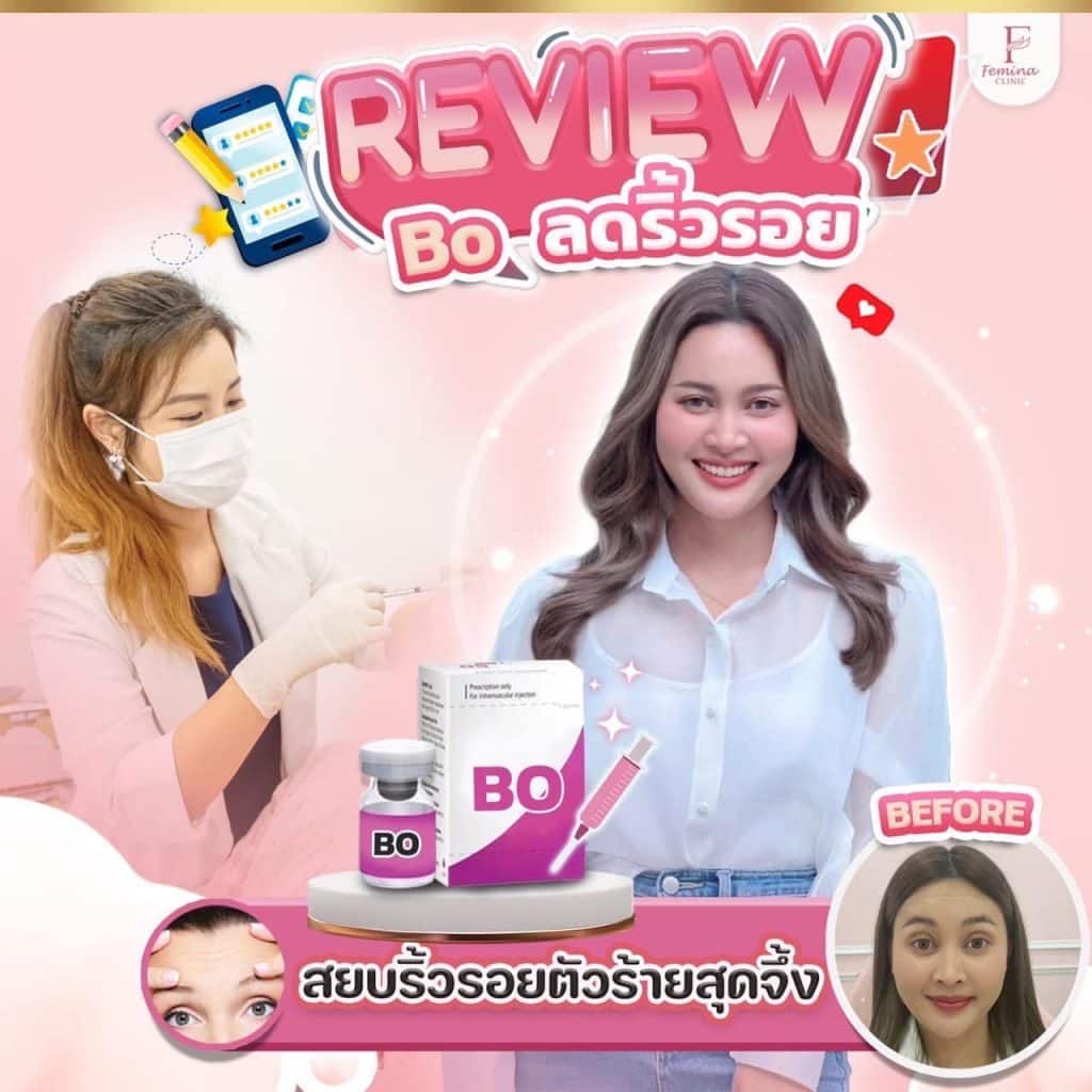 รีวิวโบท็อกซ์ลดริ้วรอย